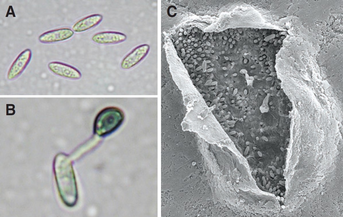 Anthracnose cells under a microscope.