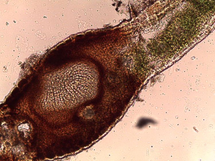 Phyllachora maydis (PLP847_2018_29) ascomata with asci on infected leaves.