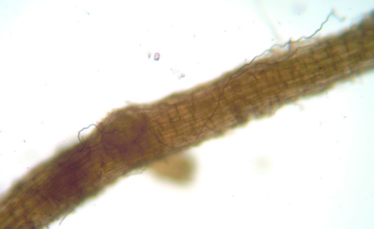 Microscopic close-up of a grass leaf blade showing dark fungal hyphae growing across the leaf tissue.