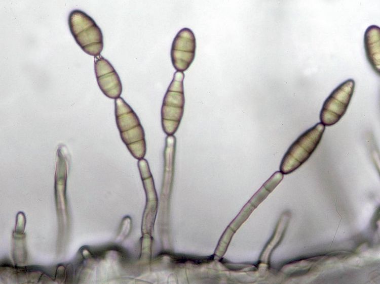 Spores of Alternaria alternata