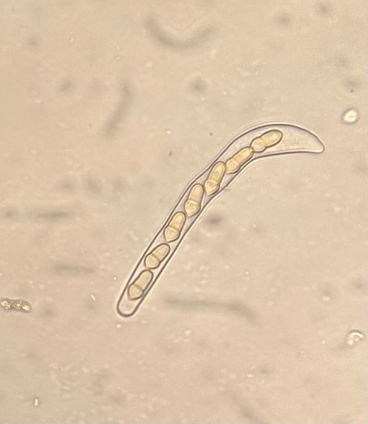 Microscopic view of primary scab ascospores.