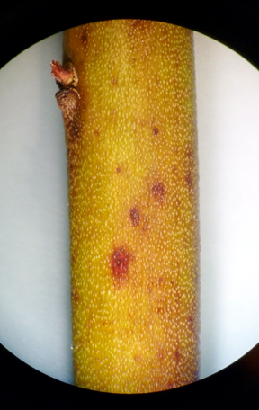 lesions lesions